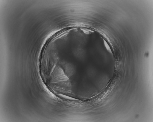 X0000099310995200805161408