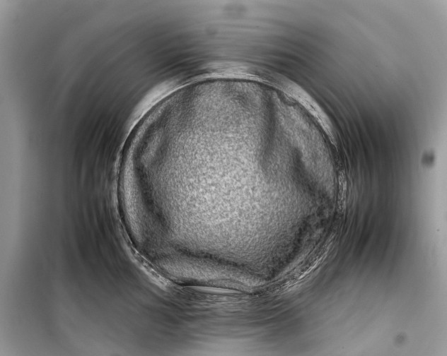 X0000099311002200805161408