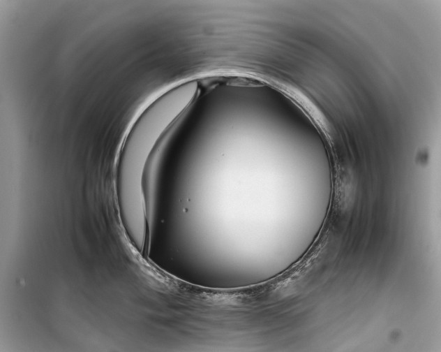 X0000099311004200805161408