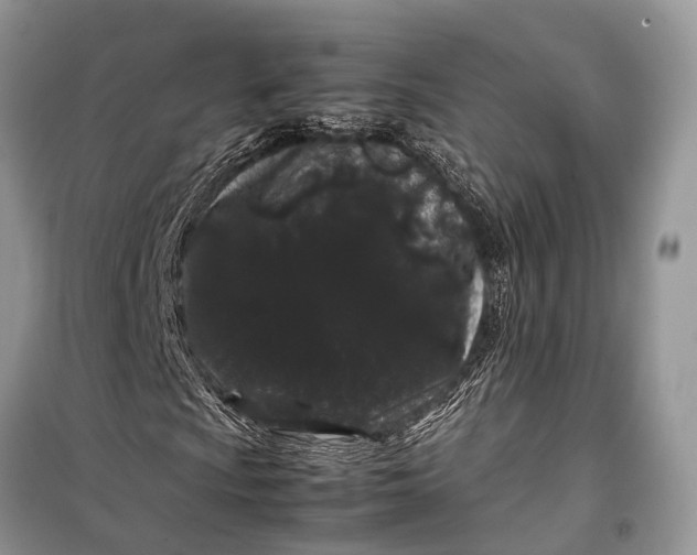 X0000099311009200805161408