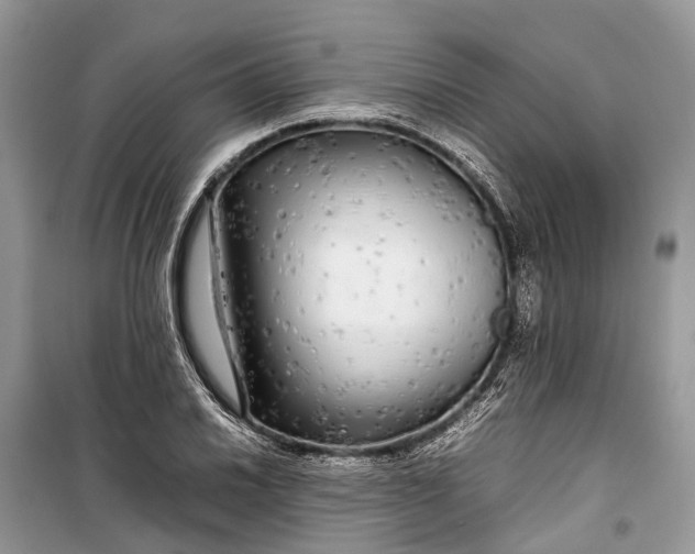 X0000099311030200805161408