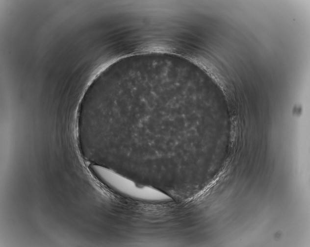 X0000099311031200805161408