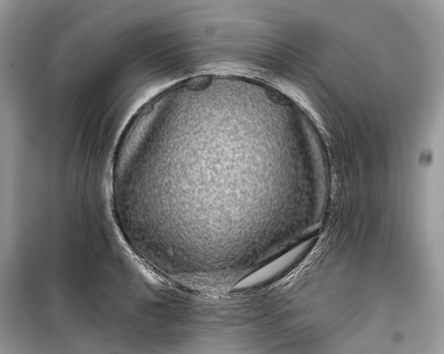 X0000099311040200805161408