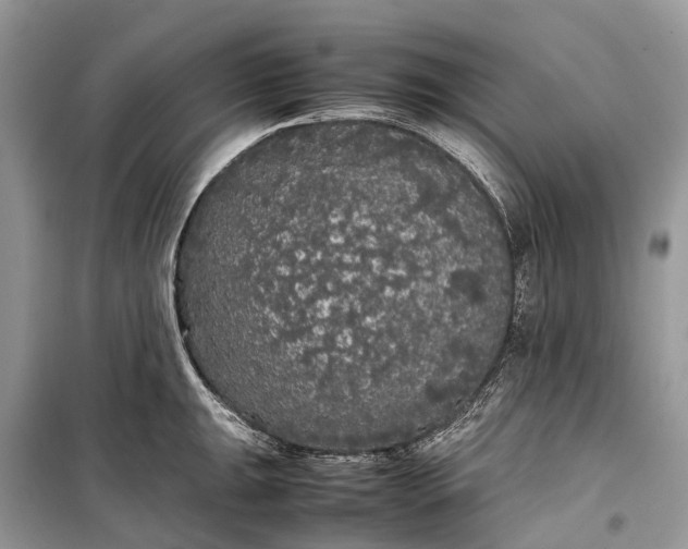 X0000099311047200805161408