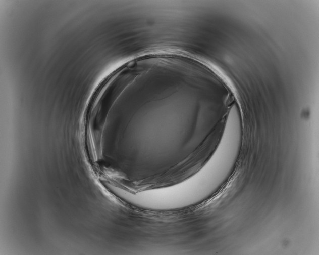 X0000099311053200805161408