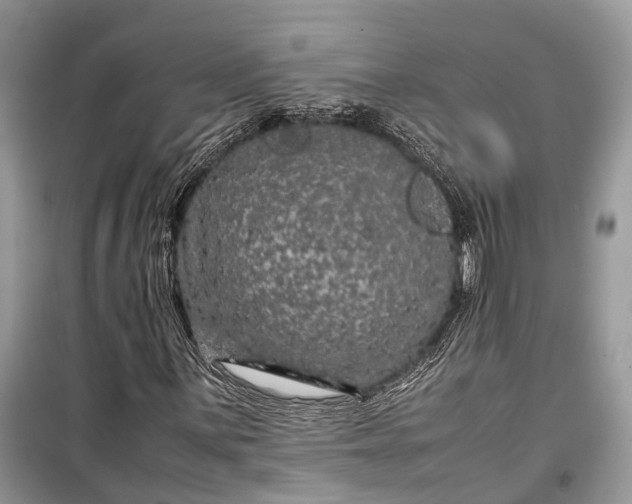 X0000099311059200805161407