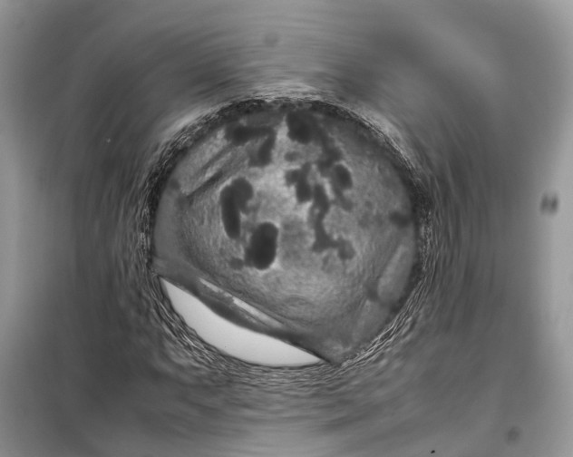 X0000099311063200805161407