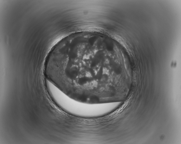 X0000099311071200805161407