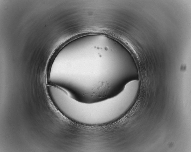 X0000099311080200805161407