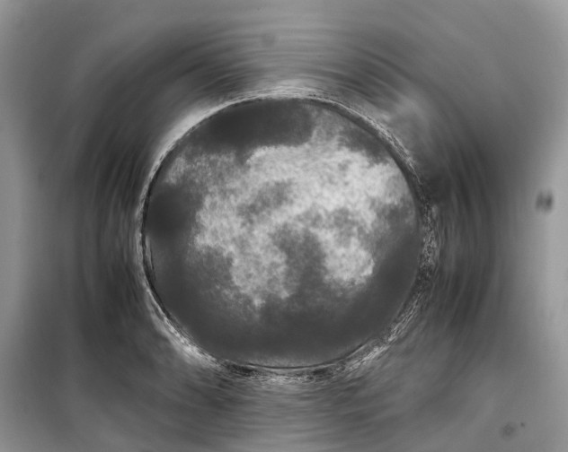 X0000099311086200805161407