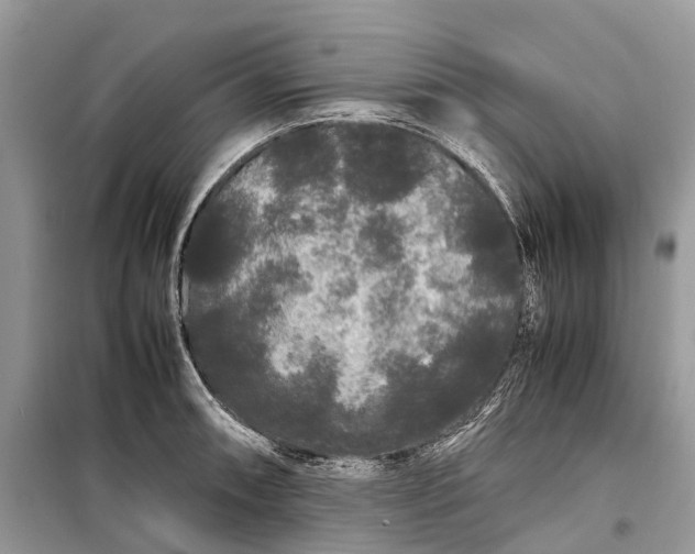 X0000099311090200805161407