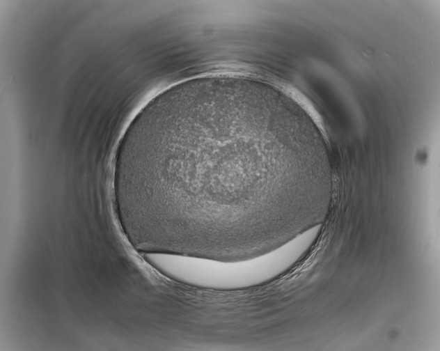 X0000099311099200805161407