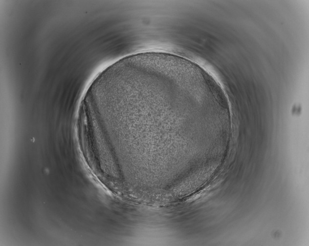 X0000099311104200805161407