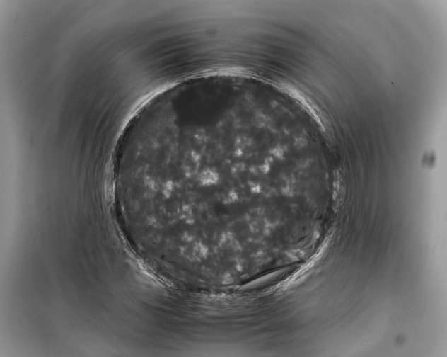 X0000099311117200805161406