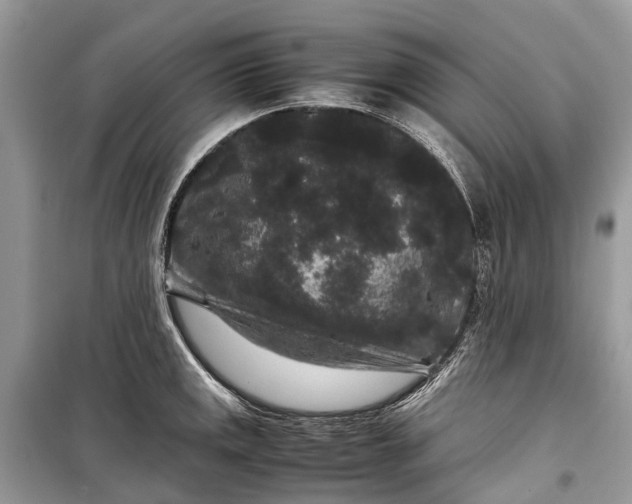 X0000099311141200805161407