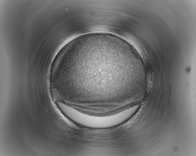 X0000099311142200805161407