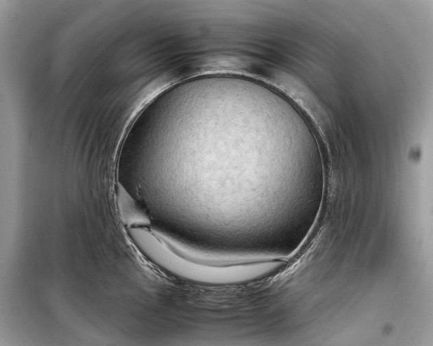 X0000099311145200805161407