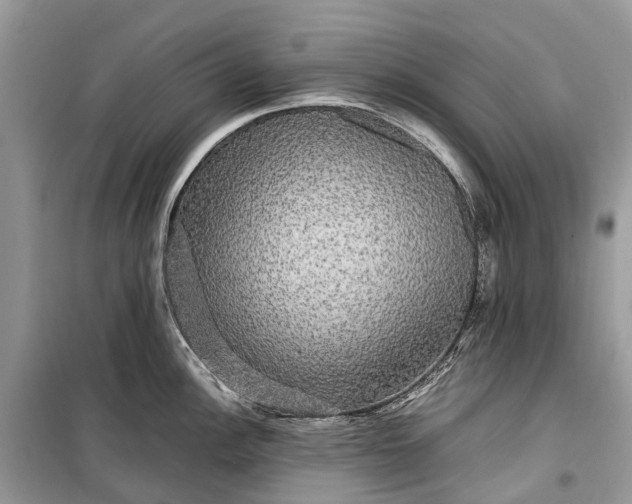 X0000099311148200805161407