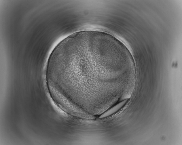 X0000099311152200805161407