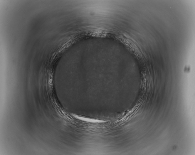 X0000099311154200805161406