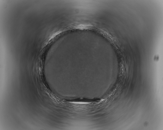 X0000099311158200805161406