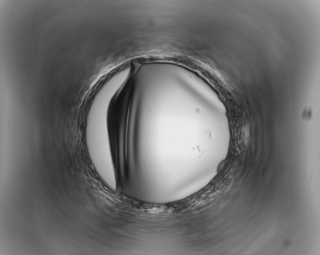 X0000099311160200805161406