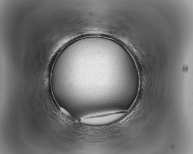 X0000099311167200805161406