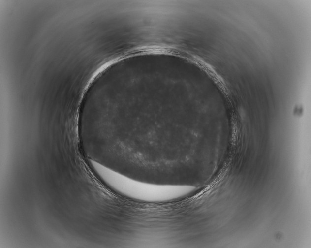 X0000099311174200805161406