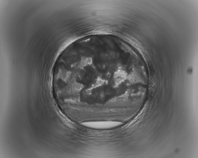 X0000099311179200805161406