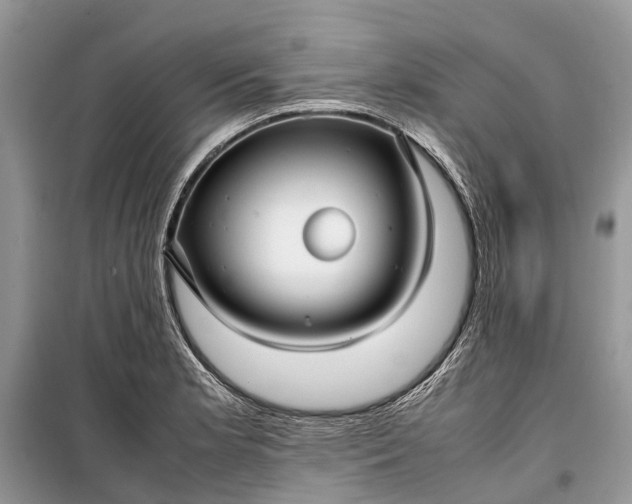 X0000099311181200805161406