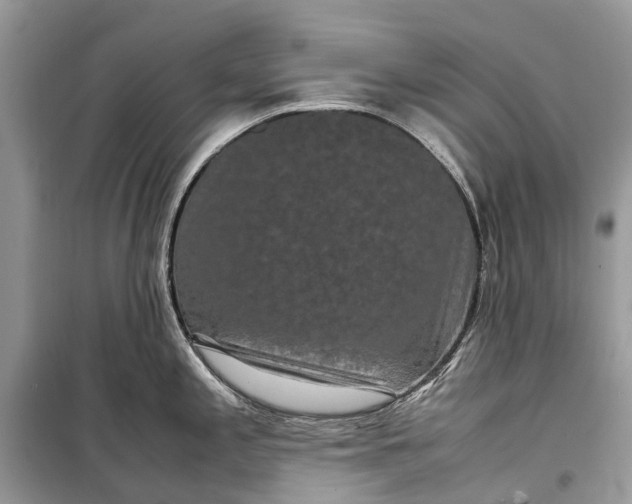 X0000099311197200805161405