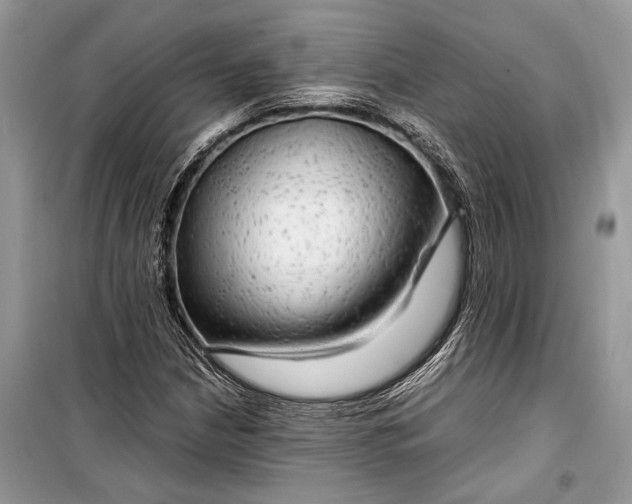 X0000099311210200805161405