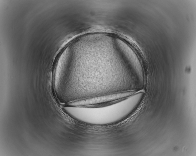 X0000099311220200805161405