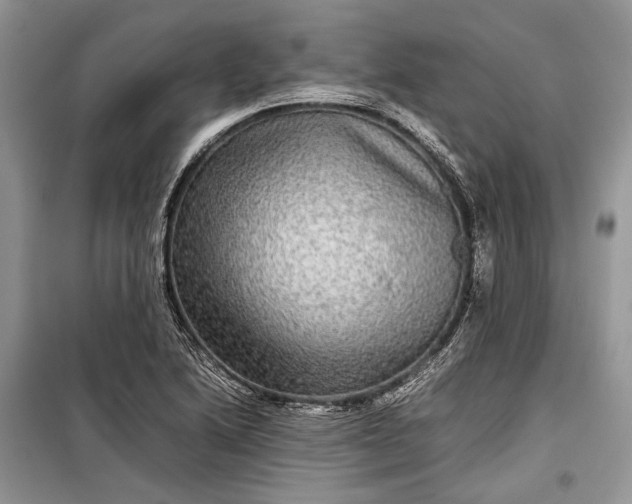 X0000099311222200805161405