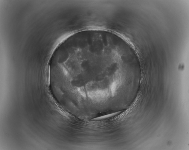 X0000099311223200805161405