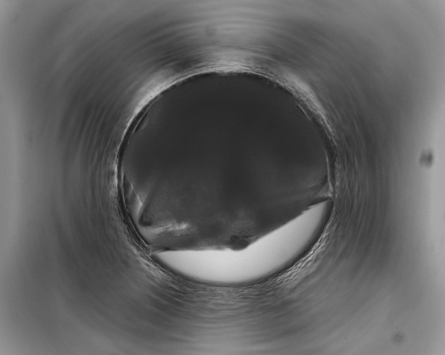 X0000099311226200805161405