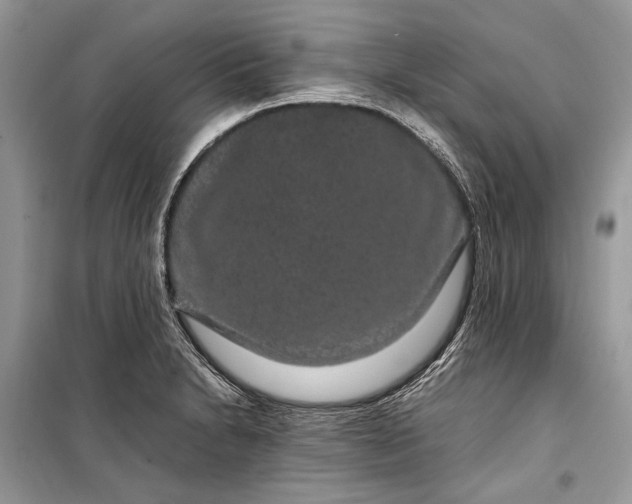 X0000099311230200805161405