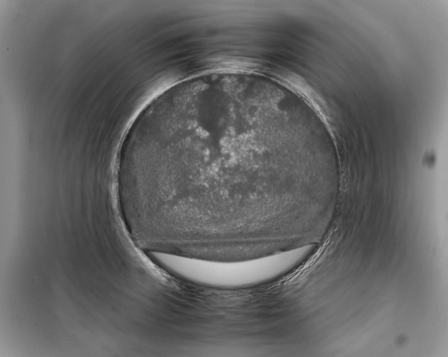 X0000099311235200805161405