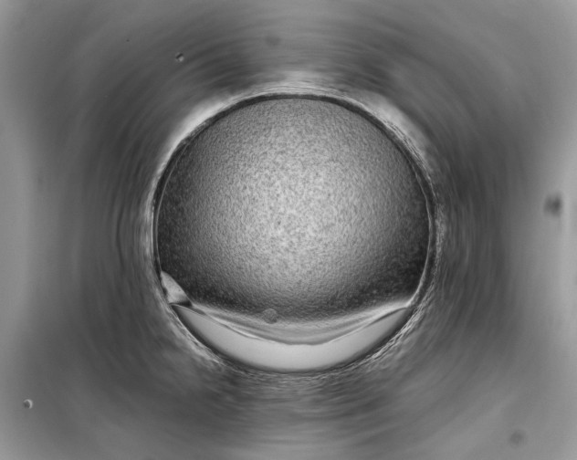 X0000099311238200805161405