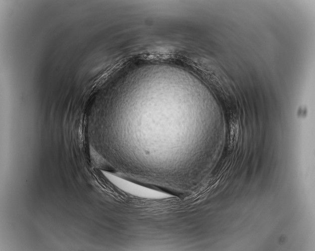 X0000099311250200805161404