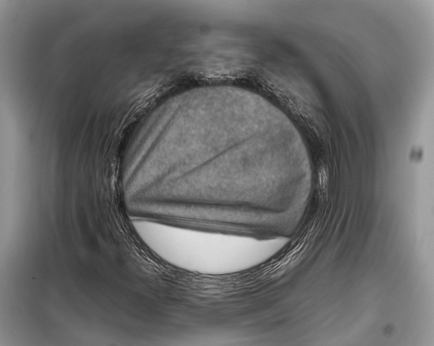 X0000099311300200805161403