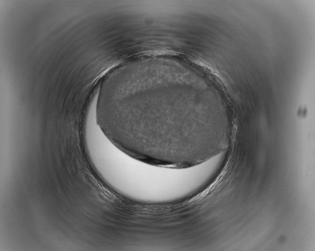 X0000099311305200805161403