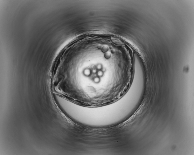 X0000099311325200805161403