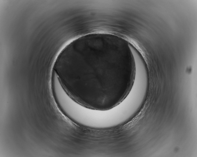 X0000099311331200805161404