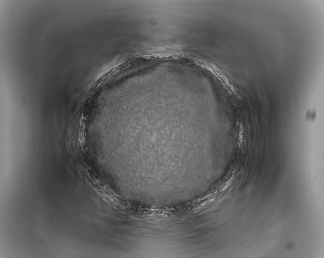 X0000099311350200805161403