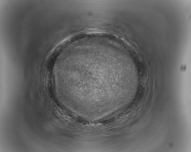 X0000099311351200805161403