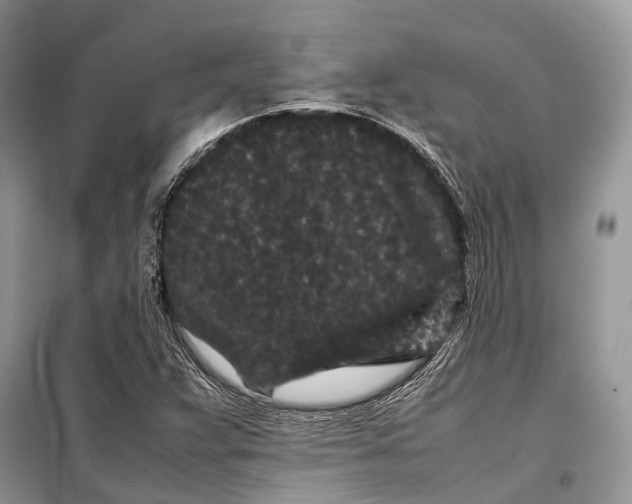 X0000099311359200805161403