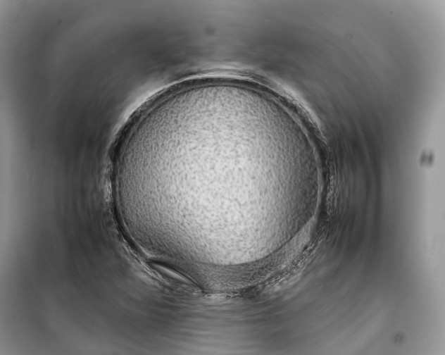 X0000099311360200805161403