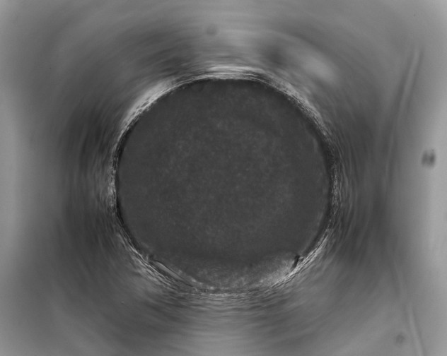 X0000099311362200805161403