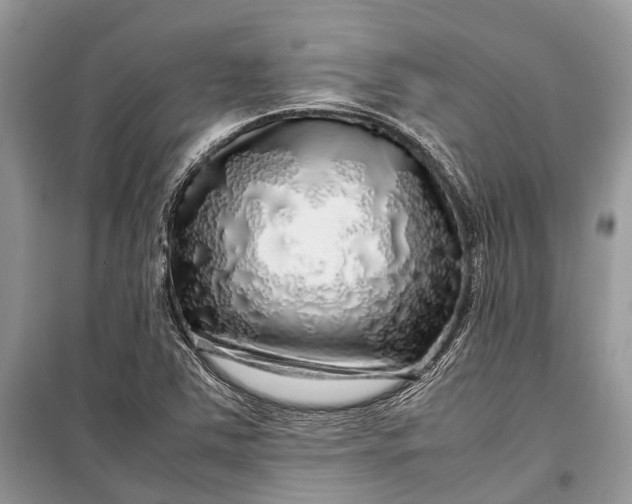 X0000099311363200805161403